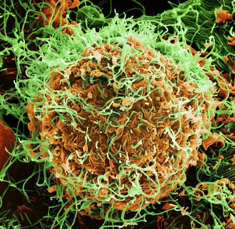 Вирус Эбола. Очень быстро размножается. Вирус вызывает геморрагическую лихорадку. Смертность человека составляет 42%