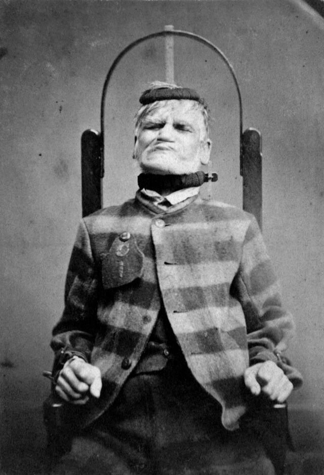 3. Пациент в кресле-ограничителе в психиатрической больнице "Западная езда" в Уэйкфилде, Англия, 1869 г.
