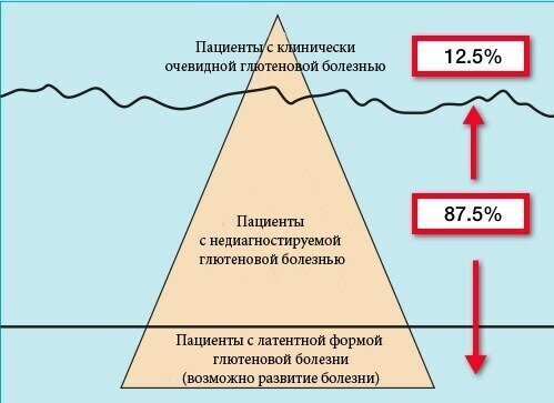 Что же такое глютен? 