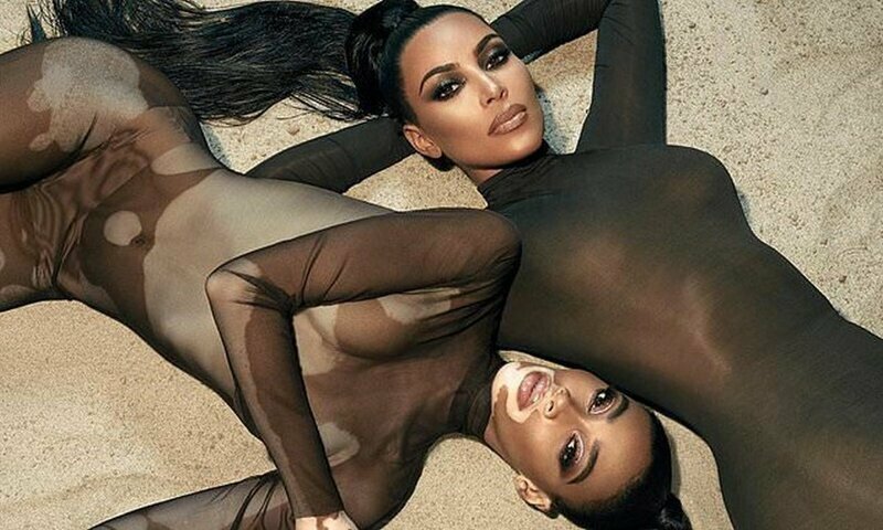 Ким Кардашьян выбрала лицом своего бренда модель с пятнами на теле