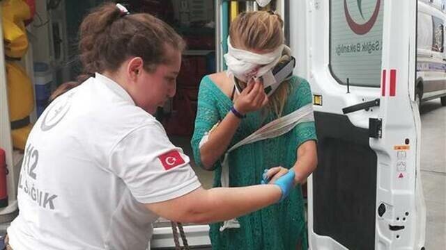 Трое россиян пострадали на шоу в Турции, когда их случайно облили кипящим маслом  !!!