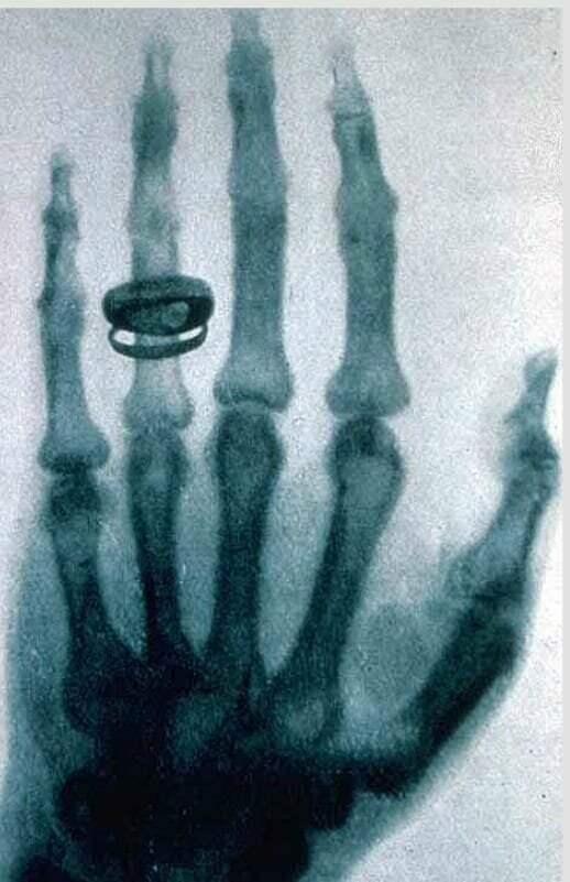 Рука смерти, получившая Нобелевскую премию (1895). 