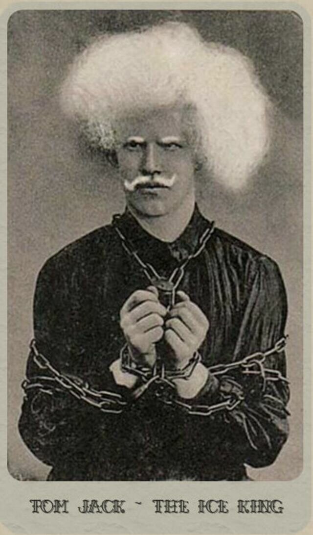 Удивительные портреты цирковых альбиносов викторианской эпохи
