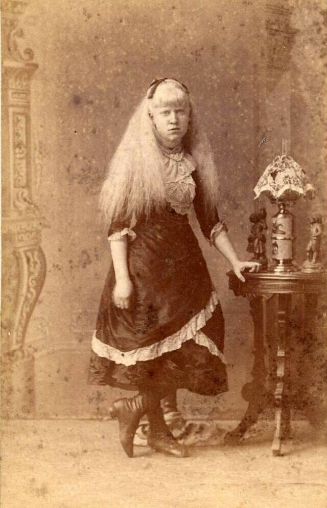 Неизвестная женщина-альбинос из передвижного цирка, 1880-е годы