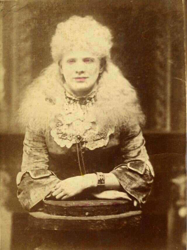 Неизвестная женщина-альбинос из передвижного цирка, 1870-е годы