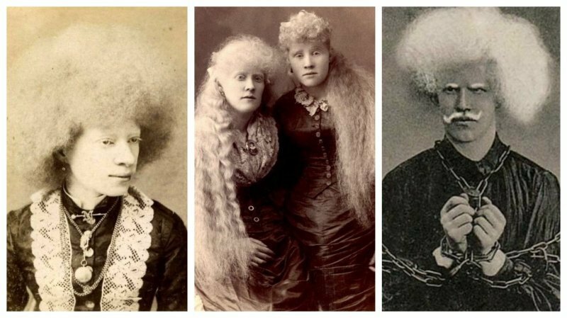 Удивительные портреты цирковых альбиносов викторианской эпохи