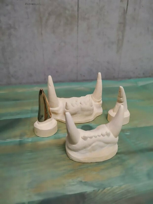 В конце августа специалисты изготовили слепок зубов Кары, чтобы создать подходящий зубной протез