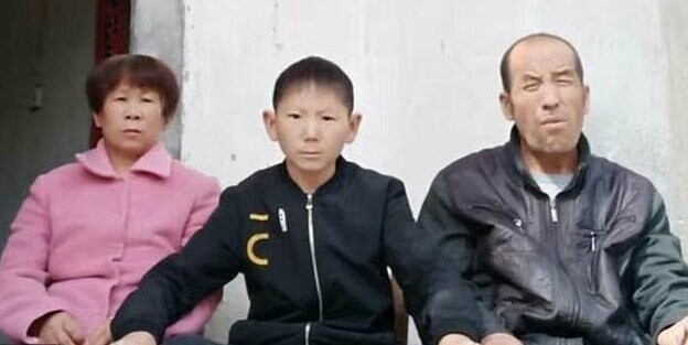 34-летний китаец застрял в теле шестилетнего ребенка из-за черепно-мозговой травмы