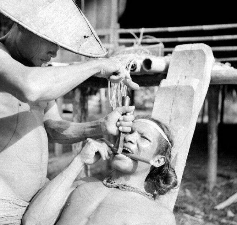 Заточка зубов у индонезийских племен, 1938 год. 