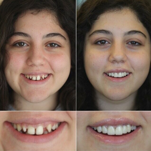 Улыбка на миллион: 20 фотографий работ стоматолога