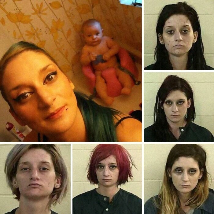 До и после: фотоистории людей, бросивших наркотики