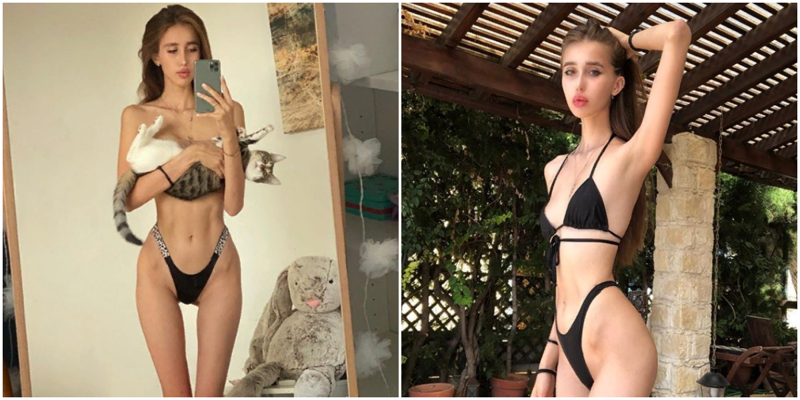 Сибирячка напугала пользователей Instagram своей худобой