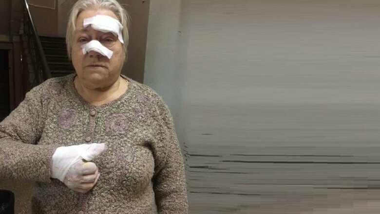 Пенсионерку отправили пешком в больницу, после того, как на неё упала остановка