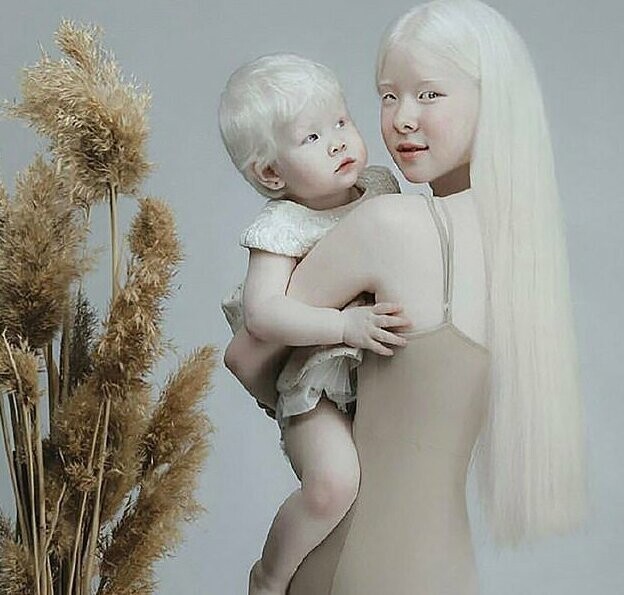 Сестры-альбиносы завоевывают модельный мир Казахстана