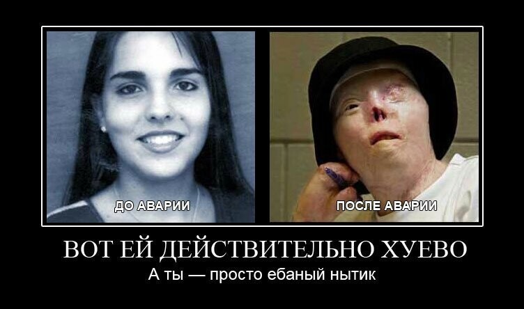 Всепропальщики