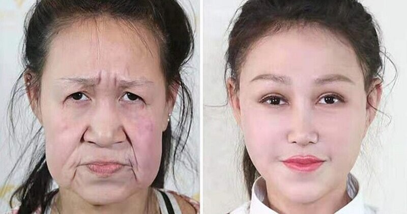 Сяо Фэн до и после пластической операции
