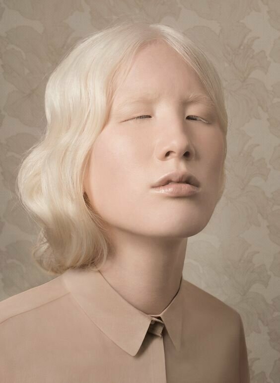 Альбиносы всегда были и будут загадочными и привлекательными для публики