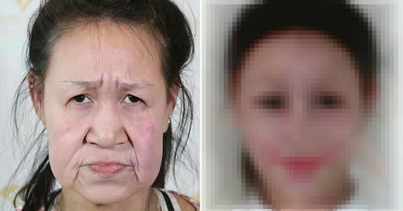 Новый облик. Китайскую девочку с лицом старушки спасла операция (9 фото)