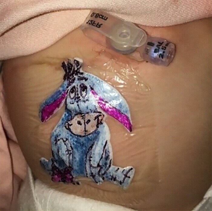 Хирург рисует мультяшек на послеоперационных повязках, чтобы поднять маленьким пациентам настроение