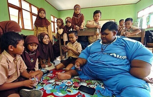 Самый толстый ребенок в мире сбросил лишний центнер