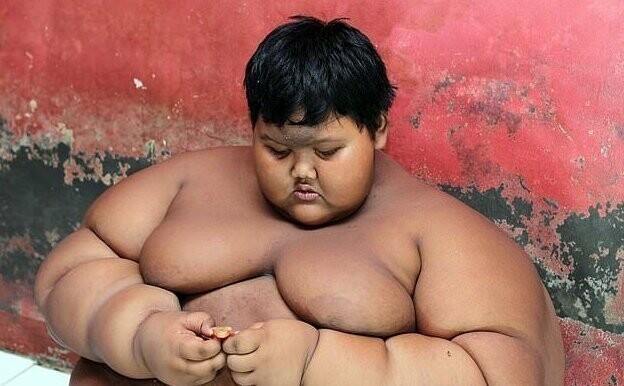 Самый толстый ребенок в мире сбросил лишний центнер