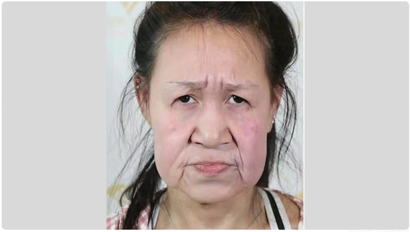 15-летней школьнице с лицом бабушки, сделали пластическую операцию