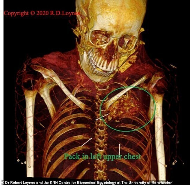 Ударили в спину: ученые выяснили причину смерти египтянки, жившей 2600 лет назад