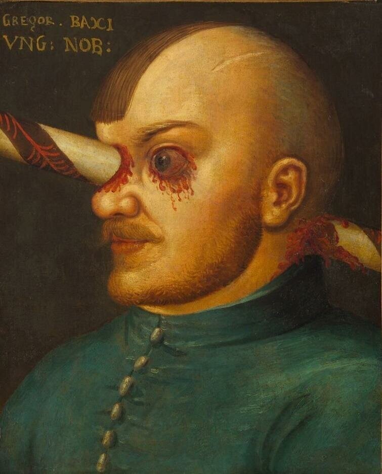 Грегор Бачи чудом выжил после удара копьем в голову. Чтобы облегчить ему жизнь, врачи отпилили копье с обоих концов возле его головы. Предполагается, что в таком состоянии он прожил один год (1500-е годы)