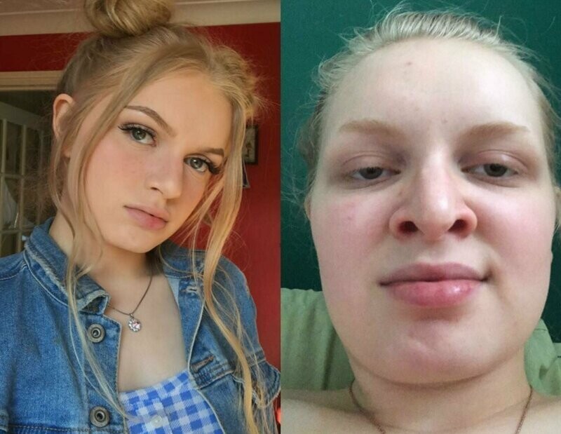 1. На фото и в жизни люди часто выглядят по-разному, особенно это касается жертв инстаграма