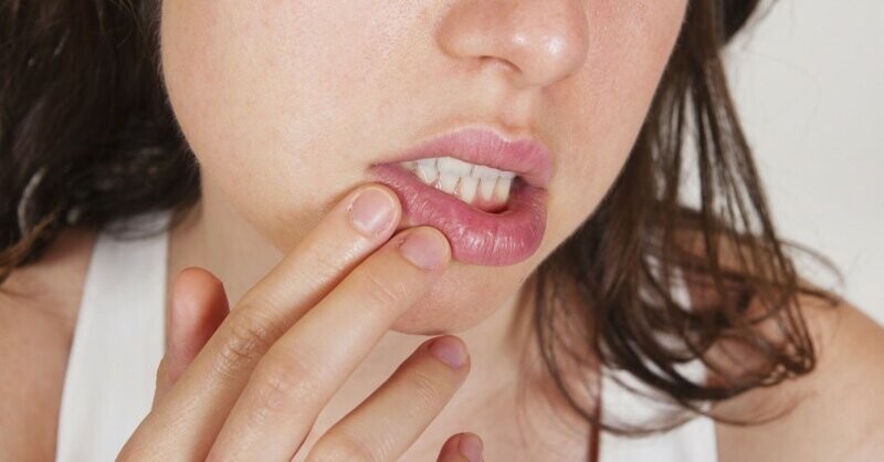 Заеды в уголках рта: причины возникновения, лечение и профилактика