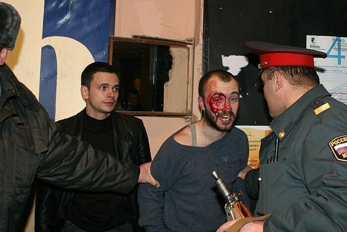 Все уже забыли, как националист Навальный выстрелил в лицо кавказцу во время драки
