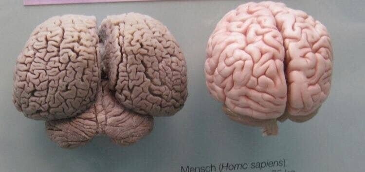 Чем мозг дельфина отличается от мозга человека? Ну, во-первых, он больше...
