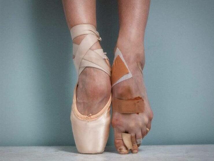 А так выглядят ноги балерин