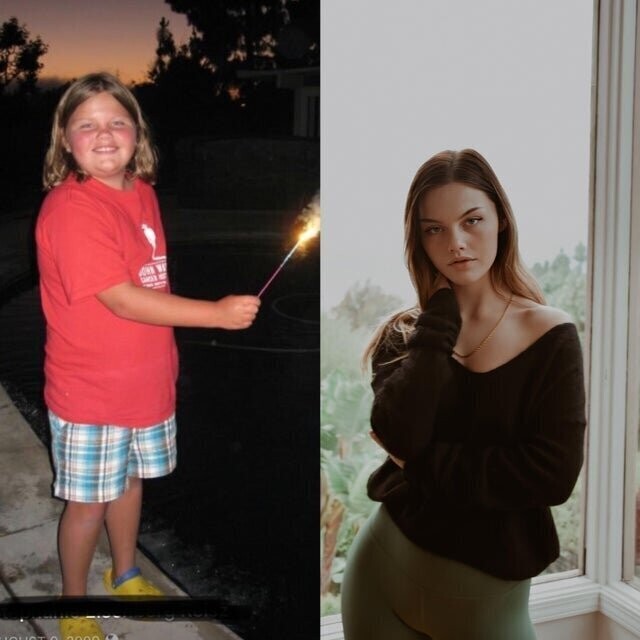 Слева я в 13 лет. Только к 20 годам я стала себе нравиться.