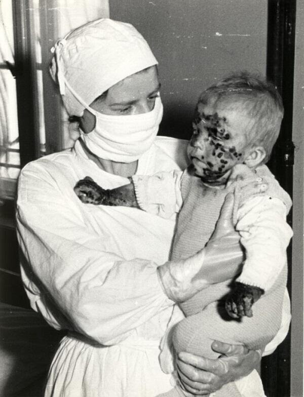 Медсестра с больным ребенком во время эпидемии оспы, Вроцлав, Польша, 1963 год.