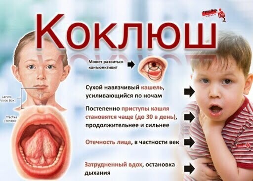 С 1957 года — введение прививки от коклюша в первый год жизни и массовая вакцинация детей СССР до 5 лет - вакцина входит в прививку АКДС