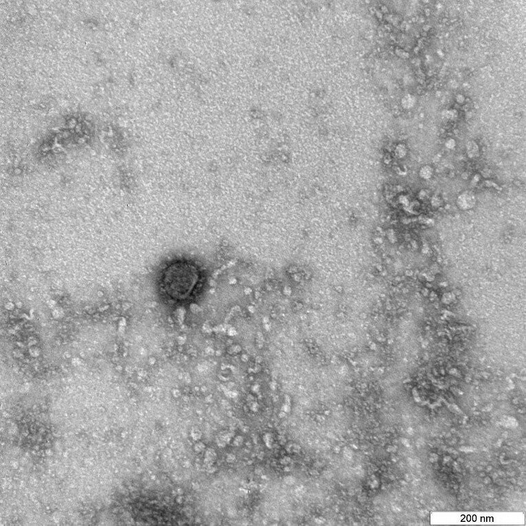 Российские ученые расшифровали полный геном бушующего коронавируса. 