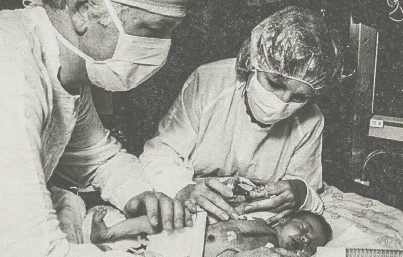 Врач Бэйли пытается покормить малышку Фэй после операции по пересадке обезьяньего сердца. 1984 год.