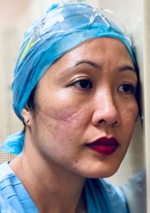 Пронзительные фото ран на лицах красавиц-медсестер, которые просят вас оставаться дома