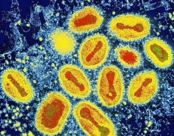 Вирус оспы, на сегодняшний день побежденный (за крайне редким исключением). Но от нее когда-то умирали миллионами