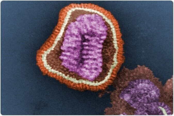 Вирус гриппа, «испанка», именуемый h2N1. Примерно 100 лет назад во время Первой мировой войны этот грипп унес от 20 до 100 млн человеческих жизней.