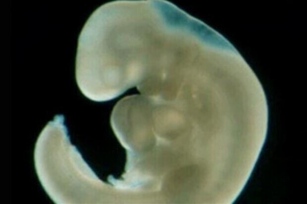 Устаревшая теория, которую преподают в школе: зачем человеческому эмбриону жабры и хвост?