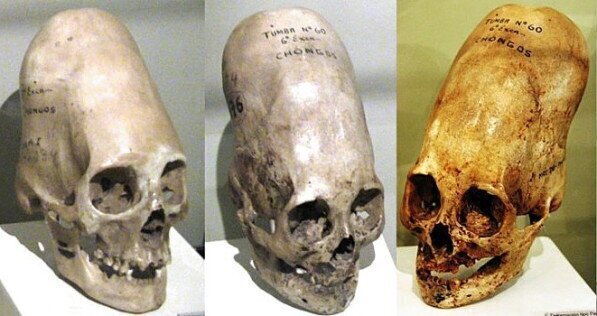 6. Реальный череп человека, найденный в Латинской Америке. Выглядит он так из-за древней культуры, практиковавшей деформацию черепа