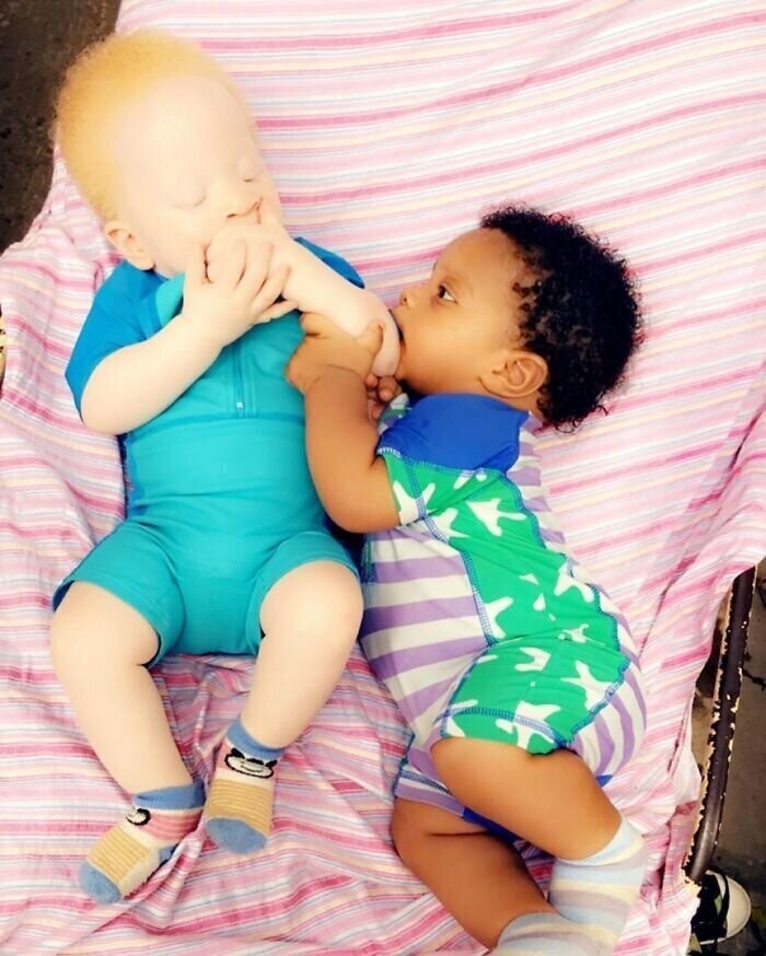 В Нигерии родились близнецы с разным цветом кожи