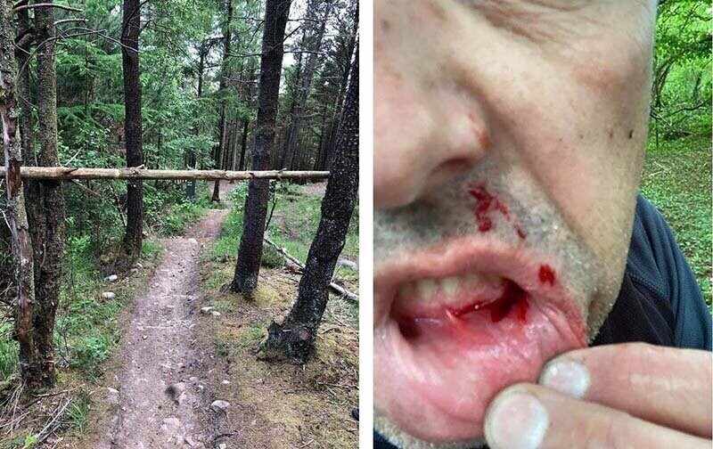 Мужчина получил жуткие травмы, напоровшись на лесной дороге на сучковатое дерево