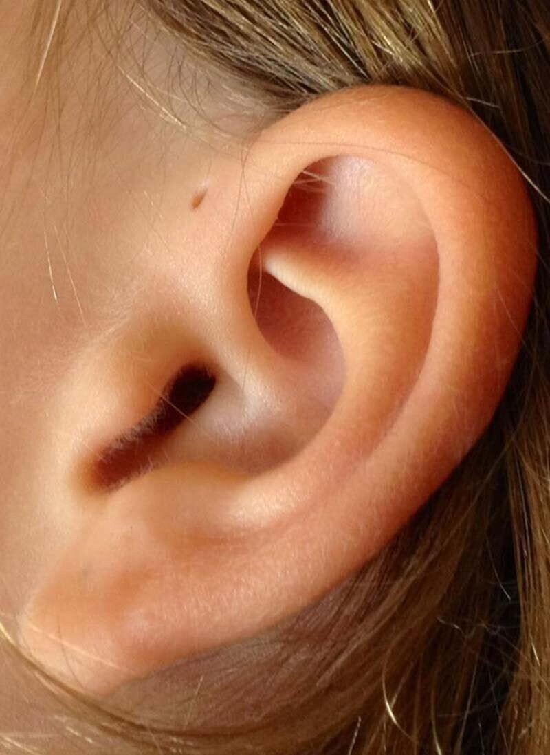 Вы знаете, почему у некоторых людей есть крошечные отверстия над ушами?
