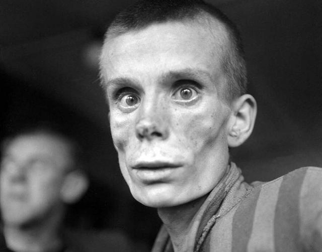 1. На этом фото истощенная 18-летняя русская девушка после освобождения из концлагеря Дахау, 1945 год