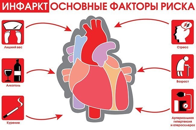 Основные причины инфаркта миокарда: