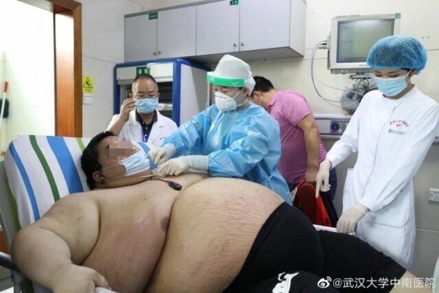 Молодой китаец за время 5-месячного карантина набрал почти центнер лишнего веса 