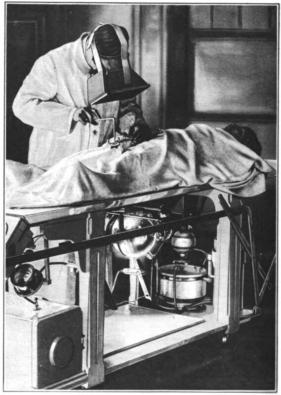 Операция солдата во время Первой мировой войны с использованием рентгеновского излучения для определения местонахождения пули. 1917
